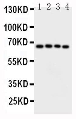 Invitrogen CAMKK2 Polyclonal Antibody 100 &mu;g; Unconjugated:Antibodies,
