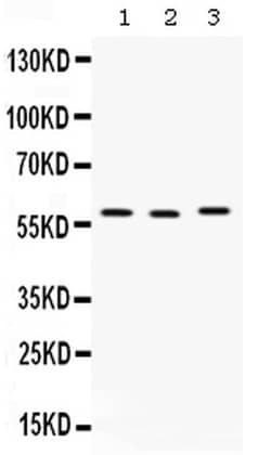 Invitrogen CAP1 Polyclonal Antibody 100 &mu;g; Unconjugated:Antibodies,