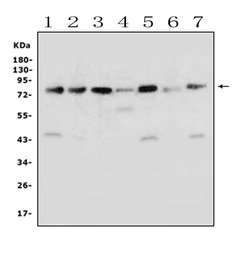 Invitrogen Calpain 1 Polyclonal Antibody 100 &mu;g; Unconjugated:Antibodies,
