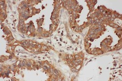 Invitrogen Calpain 1 Polyclonal Antibody 100 &mu;g; Unconjugated:Antibodies,