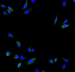 Invitrogen Calpain 2 Polyclonal Antibody 100 &mu;g | Buy Online | Invitrogen&trade; | Fisher Scientific