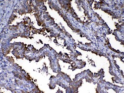 Invitrogen Calpain 2 Polyclonal Antibody 100 &mu;g | Buy Online | Invitrogen&trade; | Fisher Scientific