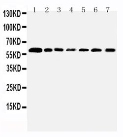 Invitrogen PRMT4 Polyclonal Antibody 100 &mu;g; Unconjugated:Antibodies,