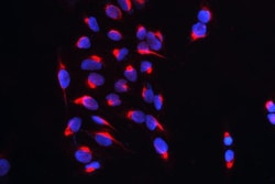 Invitrogen CARS Polyclonal Antibody 100 &mu;g; Unconjugated:Antibodies,