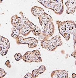 Invitrogen CARS Polyclonal Antibody 100 &mu;g; Unconjugated:Antibodies,