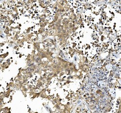 Invitrogen Caspase 6 p18 Polyclonal Antibody 100 &mu;g; Unconjugated:Antibodies,