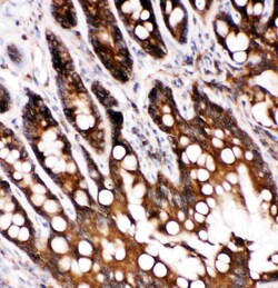 Invitrogen Caspase 6 p18 Polyclonal Antibody 100 μg; Unconjugated:Antibodies,