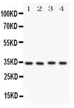 Invitrogen Caspase 7 p11 Polyclonal Antibody 100 &mu;g; Unconjugated:Antibodies