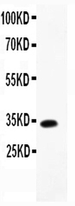 Invitrogen MCP-4 Polyclonal Antibody 100 &mu;g | Buy Online | Invitrogen&trade; | Fisher Scientific