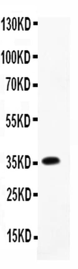 Invitrogen CCL7 (MCP3) Polyclonal Antibody 100 &mu;g; Unconjugated:Antibodies,