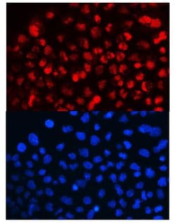 Invitrogen Cyclin T1 Polyclonal Antibody 100 &mu;g; Unconjugated:Antibodies,
