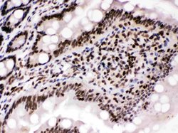 Invitrogen Cyclin T1 Polyclonal Antibody 100 &mu;g; Unconjugated:Antibodies,
