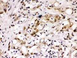 Invitrogen Cyclin T1 Polyclonal Antibody 100 &mu;g; Unconjugated:Antibodies,