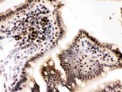Invitrogen Cyclin T1 Polyclonal Antibody 100 &mu;g; Unconjugated:Antibodies,