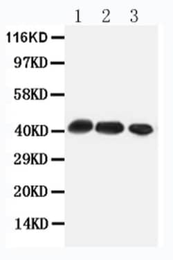 Invitrogen CCR4 Polyclonal Antibody 100 &mu;g; Unconjugated:Antibodies,