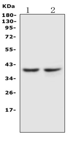 CCR5 Polyclonal Antibody:Antibodies, Polyclonal