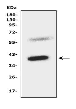 CCR5 Polyclonal Antibody:Antibodies, Polyclonal
