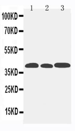 Invitrogen CCR5 Polyclonal Antibody 100 &mu;g; Unconjugated:Antibodies,