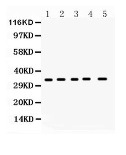 Invitrogen CCS Polyclonal Antibody 100 &mu;g | Buy Online | Invitrogen&trade; | Fisher Scientific