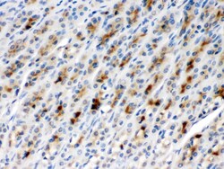 Invitrogen TCP-1 beta Polyclonal Antibody 100 &mu;g | Buy Online | Invitrogen&trade; | Fisher Scientific