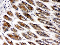 Invitrogen TCP-1 beta Polyclonal Antibody 100 &mu;g | Buy Online | Invitrogen&trade; | Fisher Scientific