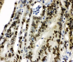 Invitrogen CCT3 Polyclonal Antibody 100 &mu;g; Unconjugated:Antibodies,