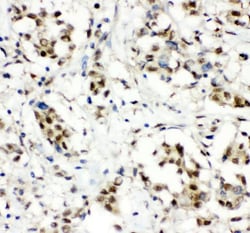 Invitrogen CCT3 Polyclonal Antibody 100 &mu;g; Unconjugated:Antibodies,