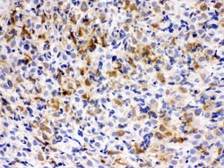 Invitrogen TCP1 epsilon Polyclonal Antibody 100 &mu;g; Unconjugated:Antibodies,