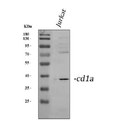 Invitrogen CD1a Polyclonal Antibody 100 &mu;g; Unconjugated:Antibodies,