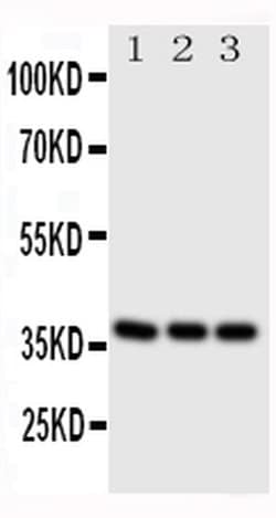 Invitrogen CD1a Polyclonal Antibody 100 &mu;g; Unconjugated:Antibodies,
