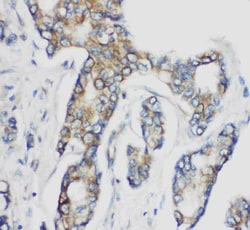 Invitrogen CD1d Polyclonal Antibody 100 &mu;g; Unconjugated:Antibodies,