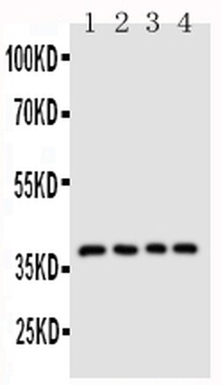 Invitrogen CD1d Polyclonal Antibody 100 &mu;g; Unconjugated:Antibodies,