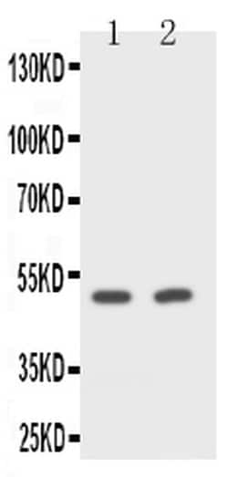 Invitrogen CD2 Polyclonal Antibody 100 &mu;g; Unconjugated:Antibodies,