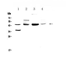 Invitrogen CD200 Polyclonal Antibody 100 &mu;g; Unconjugated:Antibodies,