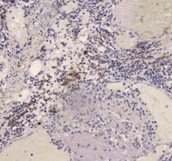 Invitrogen DC-SIGN (CD209) Polyclonal Antibody 100 &mu;g; Unconjugated:Antibodies,
