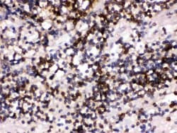 CD22 Polyclonal Antibody:Antibodies, Polyclonal