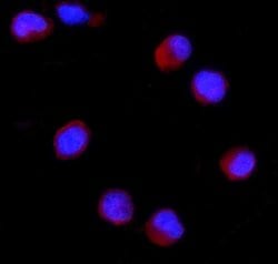Invitrogen CD27 Polyclonal Antibody 100 &mu;g; Unconjugated:Antibodies,