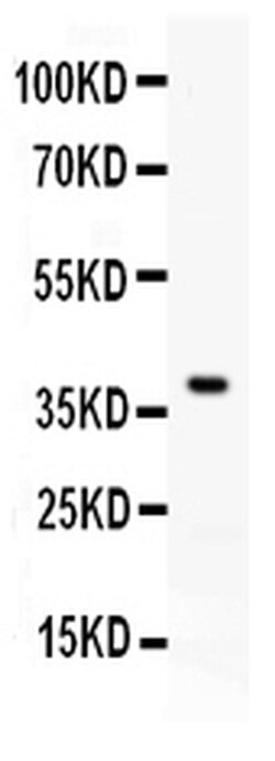 Invitrogen PD-L1 (CD274) Polyclonal Antibody 100 &mu;g; Unconjugated:Antibodies,
