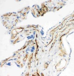 Invitrogen CD34 Polyclonal Antibody 100 &mu;g; Unconjugated:Antibodies,