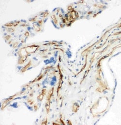 Invitrogen CD34 Polyclonal Antibody 100 &mu;g; Unconjugated:Antibodies,