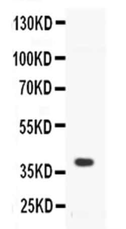 Invitrogen CD40 Polyclonal Antibody 100 &mu;g; Unconjugated:Antibodies,