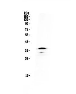 Invitrogen CD40 Polyclonal Antibody 100 &mu;g; Unconjugated:Antibodies,
