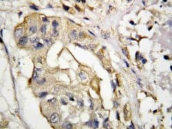 Invitrogen CD154 (CD40 Ligand) Polyclonal Antibody 100 &mu;g; Unconjugated:Antibodies,