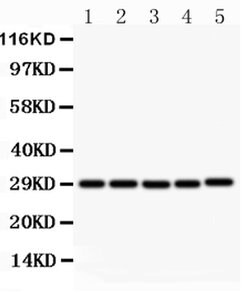 Invitrogen CD154 (CD40 Ligand) Polyclonal Antibody 100 &mu;g; Unconjugated:Antibodies,