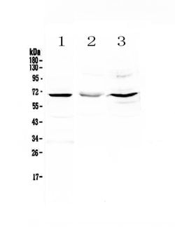 Invitrogen CD5 Polyclonal Antibody 100 &mu;g; Unconjugated:Antibodies,