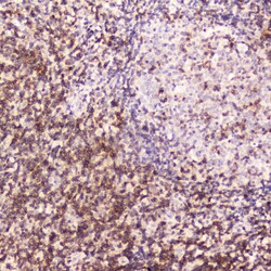 Invitrogen CD5 Polyclonal Antibody 100 &mu;g | Buy Online | Invitrogen&trade; | Fisher Scientific