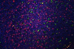 Invitrogen CD5 Polyclonal Antibody 100 &mu;g | Buy Online | Invitrogen&trade; | Fisher Scientific