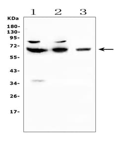 Invitrogen CD5 Polyclonal Antibody 100 &mu;g | Buy Online | Invitrogen&trade; | Fisher Scientific