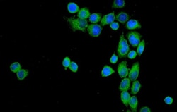 Invitrogen CD55 Polyclonal Antibody 100 &mu;g | Buy Online | Invitrogen&trade; | Fisher Scientific