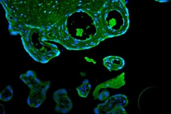 Invitrogen CD55 Polyclonal Antibody 100 &mu;g | Buy Online | Invitrogen&trade; | Fisher Scientific